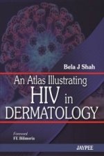 Atlas Illustrating HIV in Dermatology