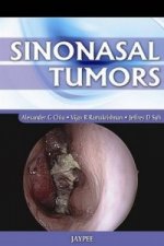 Sinonasal Tumors