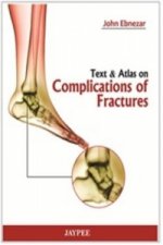 Text and Atlas of Complications of Fractures