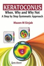 Keratoconus: When, Why and Why Not: A Step by Step Systematic Approach