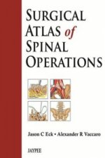 Surgical Atlas of Spinal Operations