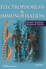 Electrophoresis & Immunofixation