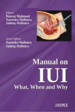 Manual on IUI: What, When and Why