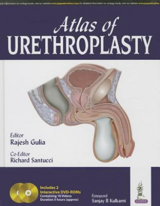 Atlas of Urethroplasty