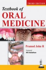 Textbook of Oral Medicine