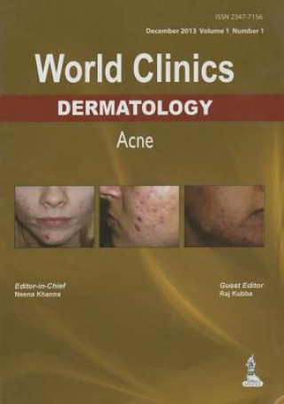 World Clinics: Dermatology - Acne