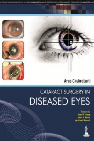 Cataract Surgery in Diseased Eyes