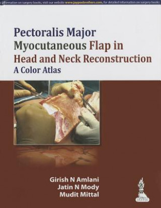 Pectoralis Major Myocutaneous Flap in Head and Neck Reconstruction: A Color Atlas