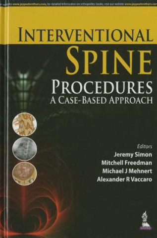 Interventional Spine Procedures