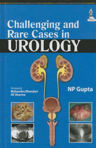 Challenging and Rare Cases in Urology