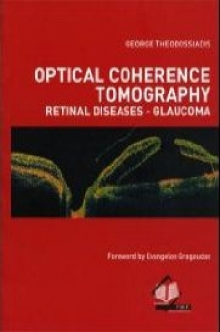 Optical Coherence Tomography Retinal Diseases - Glaucoma