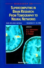Supercomputing in Brain Research