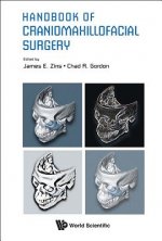 Handbook Of Craniomaxillofacial Surgery