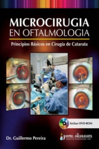 Microcirugia en Oftalmologia: Principios Basicos en Cirugia de Catarata