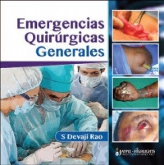 Emergencias Quirurgicas Generales