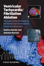 Ventricular Tachycardia / Fibrillation Ablation - The State of the Art based on the Venicechart International Consensus Document