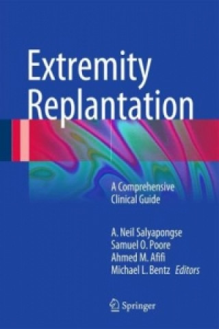 Extremity Replantation, 1