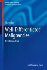 Well-Differentiated Malignancies, 1