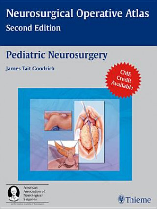 Pediatric Neurosurgery