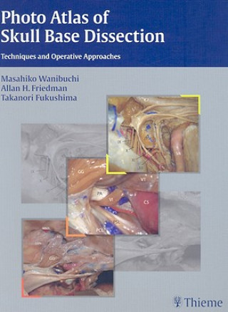Photo Atlas of Skull Base Dissection