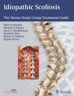 Idiopathic Scoliosis