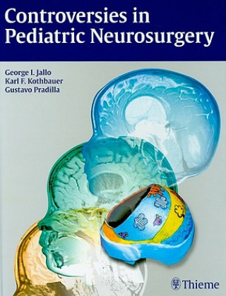 Controversies in Pediatric Neurosurgery
