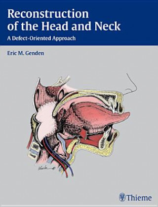 Reconstruction of the Head and Neck (Eric M. Genden)(Twarda)