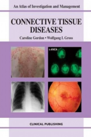 Connective Tissue Diseases