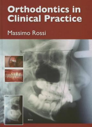 Orthodontics in Clinical Practice