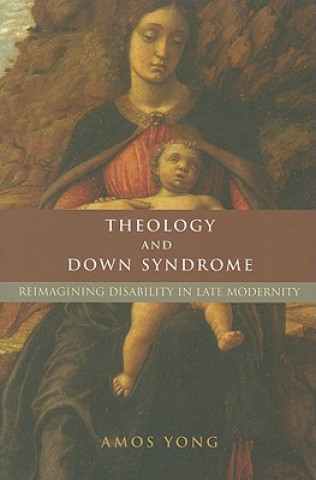 Theology and Down Syndrome