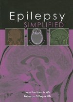 Epilepsy Simplified