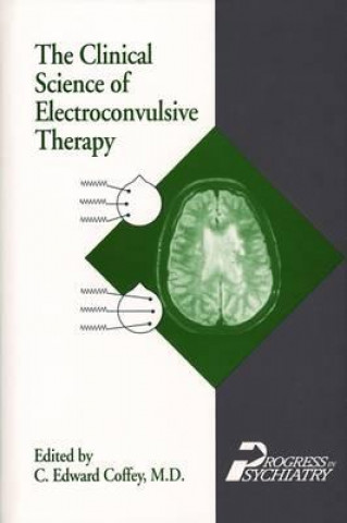 Clinical Science of Electroconvulsive Therapy