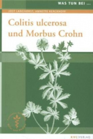 Colitis ulcerosa und Morbus Crohn