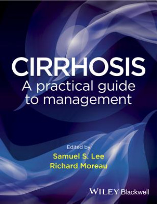 Cirrhosis - A practical guide to management