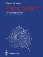 Transfixation