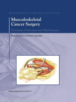 Musculoskeletal Cancer Surgery, 1