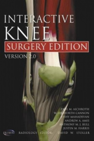 Interactive Knee: Surgery