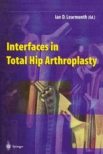 Interfaces in Total Hip Arthroplasty