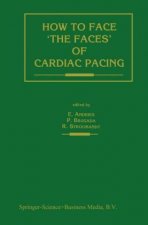 How to face 'the faces' of CARDIAC PACING