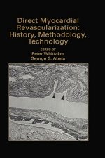 Direct Myocardial Revascularization: History, Methodology, Technology
