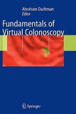 Fundamentals of Virtual Colonoscopy