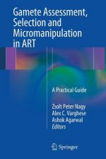 Gamete Assessment, Selection and Micromanipulation in ART