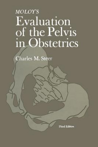 Moloy's Evaluation of the Pelvis in Obstetrics