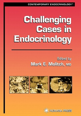Challenging Cases in Endocrinology