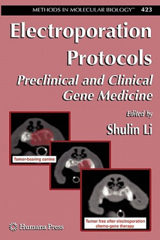 Electroporation Protocols