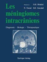 Les meningiomes intracraniens