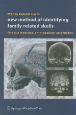 New Method of Identifying Family Related Skulls