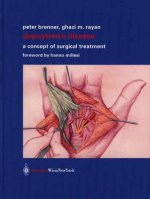 Dupuytren's Disease