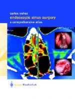 Endoscopic Sinus Surgery