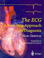ECG